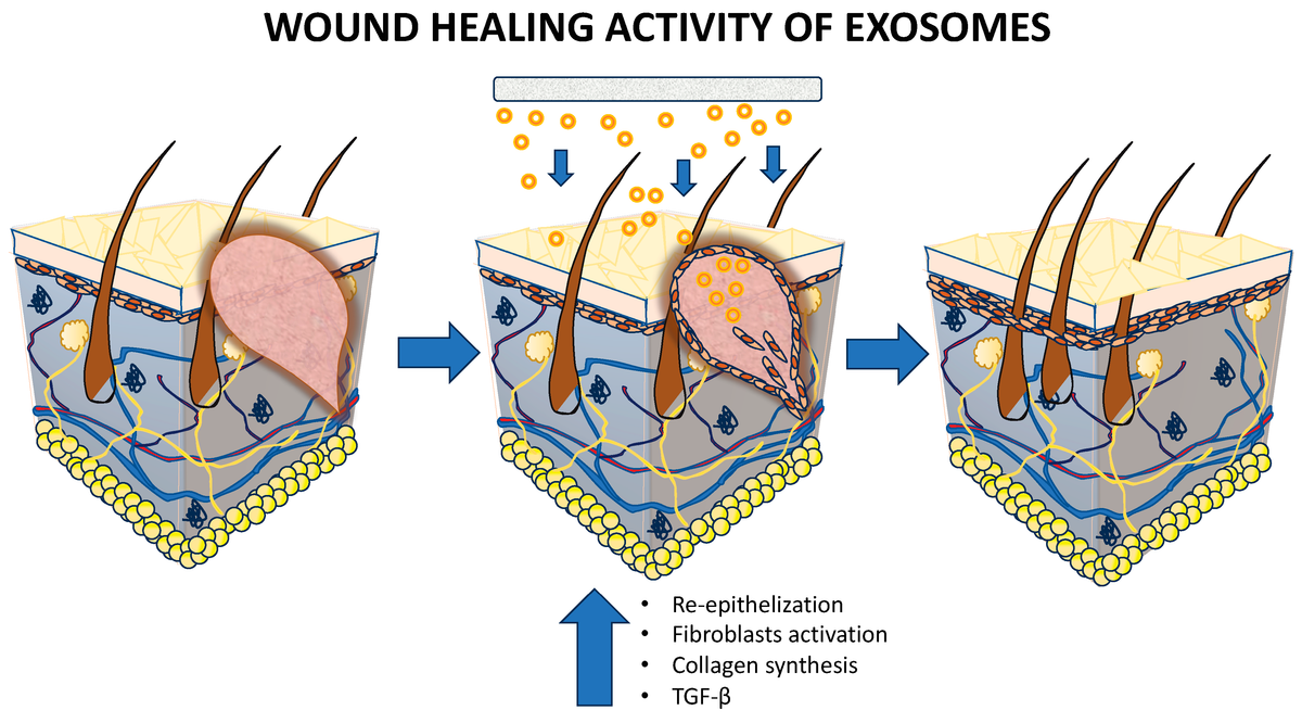 NetWork: Exosomes in Wound Healing