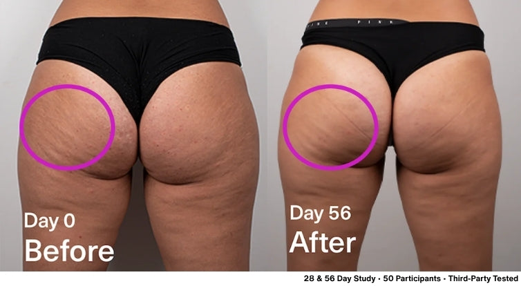 DropOff - Body Sculpting Lipo Serum, Firmer & Smoother Look and Feel